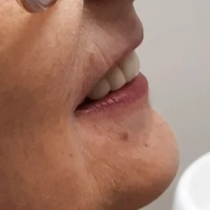 ESTETICA ANT FINAL ROSTRO