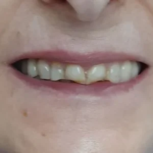 ESTETICA ANT