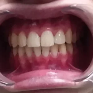 FINAL DENTAL