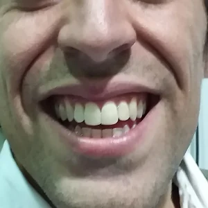 FINAL ROSTRO
