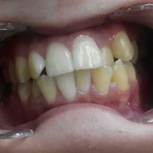 INICIAL DENTAL