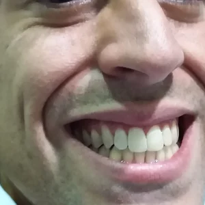 PERFIL